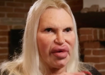 Fulvia (56): “Ik heb 150 operaties ondergaan en ik heb mijn droomuiterlijk bereikt”