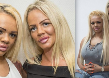 Moeder (42) en dochter (24) hebben samen 80.000 euro uitgegeven aan cosmetische ingrepen: “Betaald van geld van sugar daddy’s”