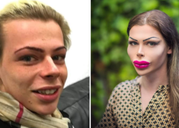 Patrick wil eruitzien als een pop: “Ik vind mijzelf prachtig zo”