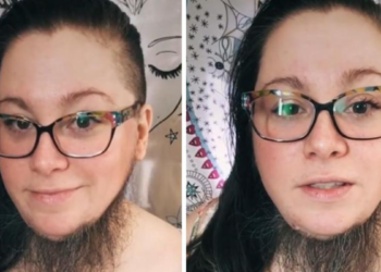 Vrouw is scheren zat en laat haar baard staan: “Zelfs mannen zijn jaloers op mijn baard”