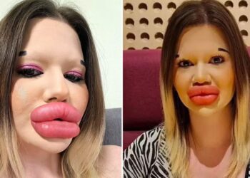 Andrea (31): “Ik ben doodongelukkig omdat ik al jaren geen liefde heb gevonden”