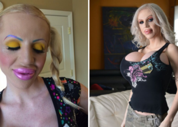 Juliette (38) is trots op haar verbouwingen: “Wil borsten groter dan mijn hersenen!”