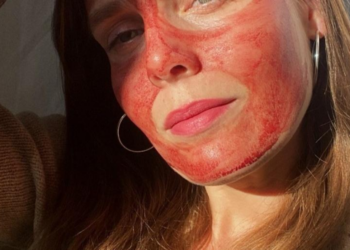 De trend van 2024: Menstruatiebloed als gezichtsmasker