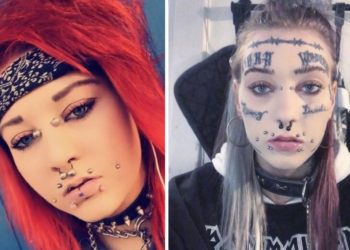 Harly (24): “Ik heb 20.000 euro uitgegeven mijn uiterlijk en ik dit is de beste keuze ooit”