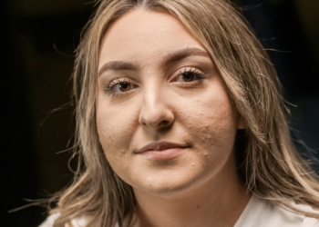 Melanie (34): “Ik eet maar 1.500 calorieën per dag en kom nog steeds aan”