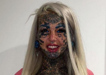 Amber (29): “Overal waar ik kom, maken mensen me belachelijk vanwege mijn uiterlijk”