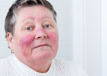 Anja (58): “Ik betaalde 2,50 voor een oliebol, dat is toch niet normaal meer?”