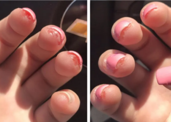 Heb jij (kunst) gelnagellak? Dit kan ernstige gevolgen hebben voor jouw gezondheid