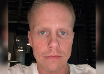 André Hazes ‘verliest wenkbrauwen’ door vuurwerk bij show