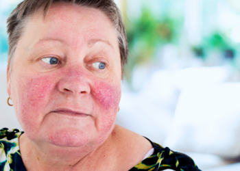 Annet (53): “Mijn buren krijgen wél subsidie voor zonnepanelen, maar ik niet – en de reden slaat nergens op!”