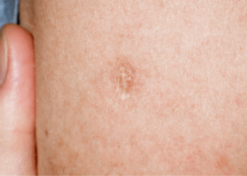 Dit is de onverwachte betekenis van dit litteken op je linkerbovenarm