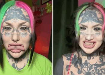 Vrouw die 70.000 euro uitgaf aan transformatie laat zien hoe ze er vroeger uitzag: “Wat een verschil!”